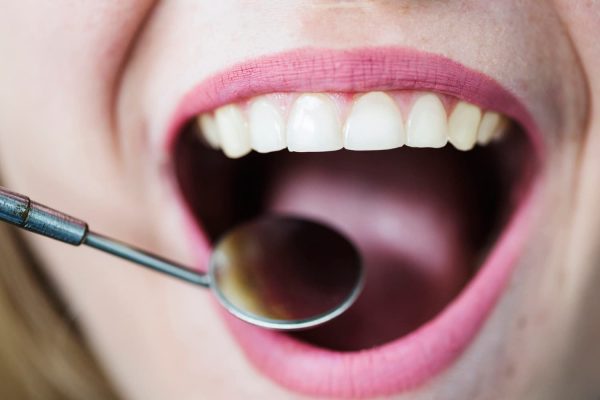 Consejos para una buena salud bucodental